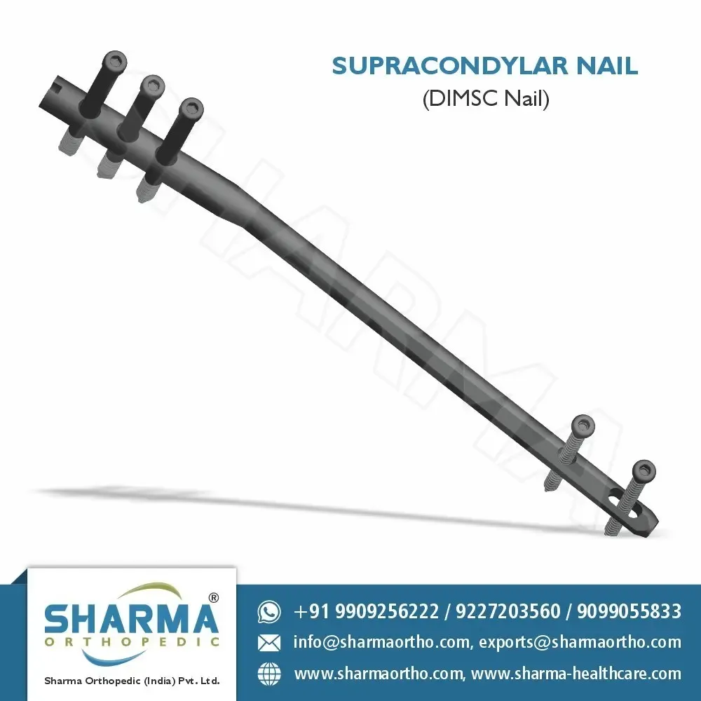 High-Quality Intramedullary Interlocking Nails | Sharma Orthopedic - Services in Vadodara (Image 3)
